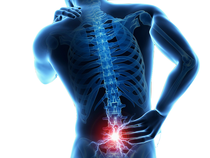 lumbar ciatica