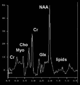 espectroscopia por resonancia magnética