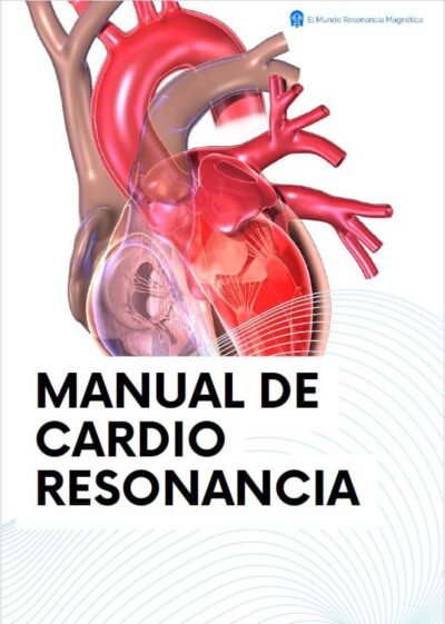 Manual de Cardio Resonancia