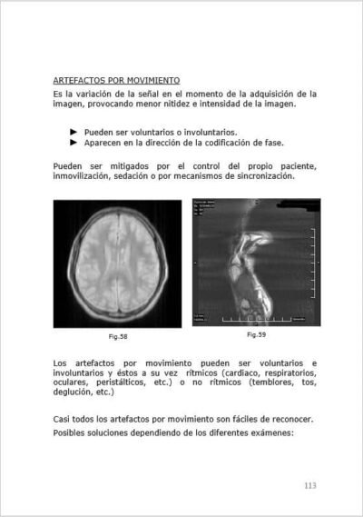 asi2 1 El Mundo Resonancia Magnética