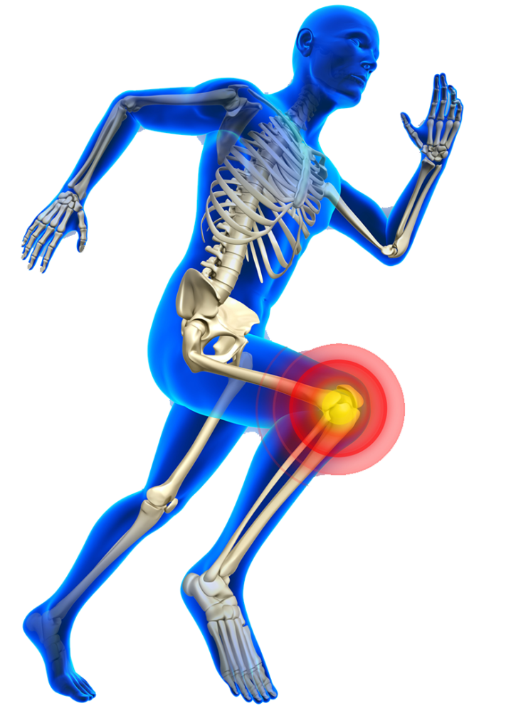 lesiones de rodilla