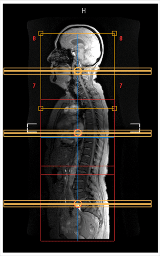 resonancia magnetica columna completa