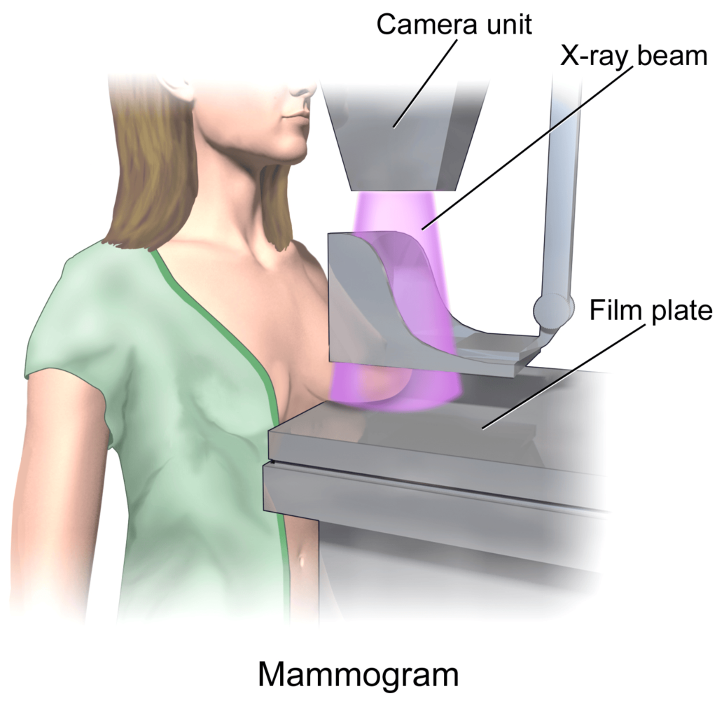 técnica de mamografía