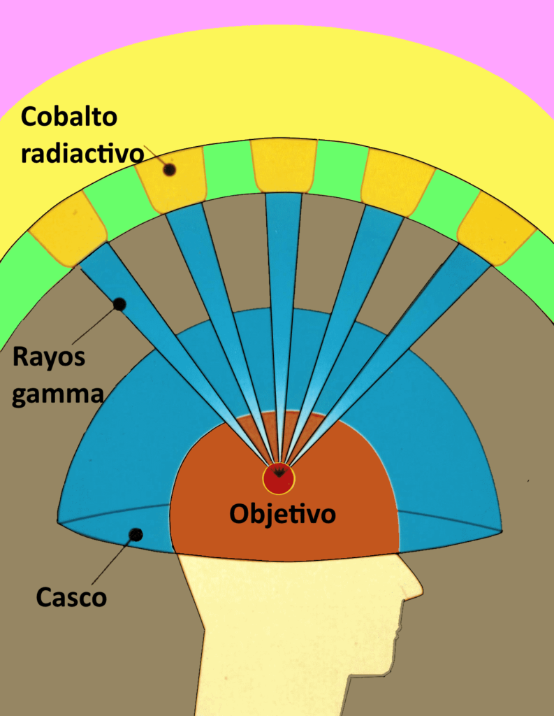 gamma knife