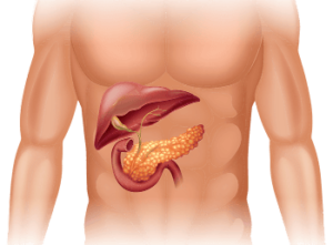cancer de pancreas