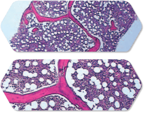 celulas cancerigenas vs celulas sanas