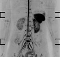 difusión 3D cuerpo completo