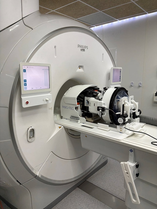 antena de cerebro HIFU