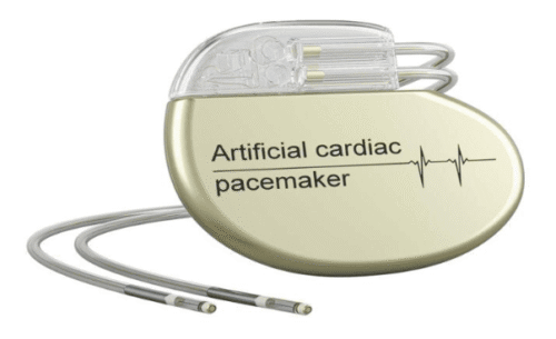 Marcapasos y resonancia magnética: lo que necesitas saber 3 marcapasos cardiaco